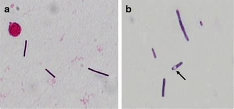 Gram Stain Morphology Of Clostridium Septicum From Csf A My Xxx Hot Girl