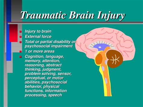 Mild Traumatic Brain Injury Drbeckmann