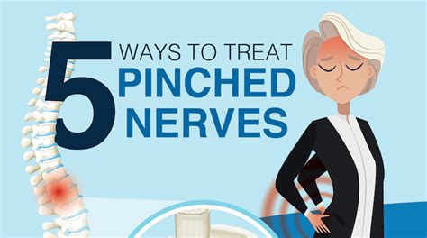 5 Ways To Treat Pinched Nerves
