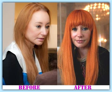 Tori Amos Plastic Surgery Before And After Tori Amos Plastic Surgery Toriamosplasticsurgery