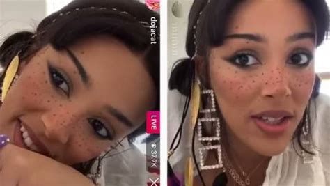 Doja Cat Fights Back Plastic Surgery Rumors Claims Shes All Natural