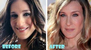 Sarah Jessica Parker Plastic Surgery Before And After Nose Job Lovely Surgery