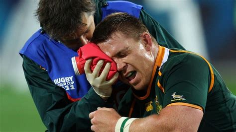 Concussion In Rugby Needs To Be Controlled