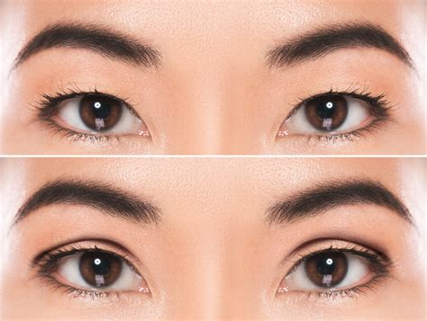 What Is A Double Eyelid Images And Photos Finder