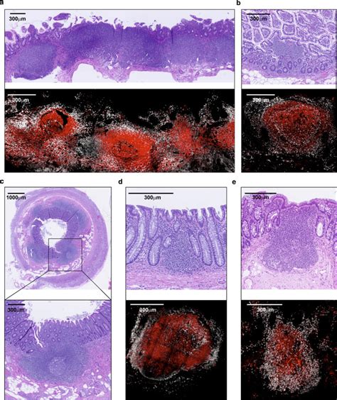 Human Gut Associated Lymphoid Tissues Galt Diversity Structure And