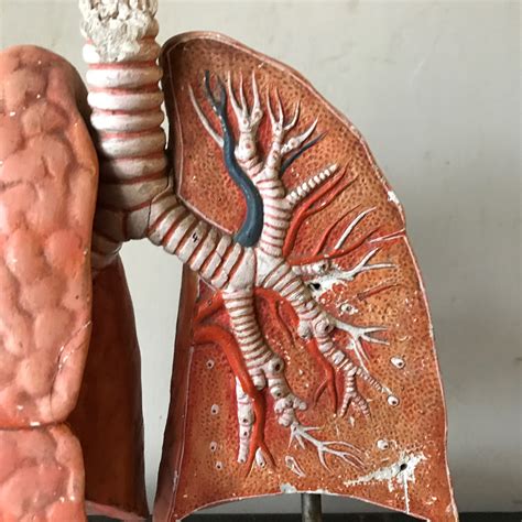 Accessmedicine Content Lung Anatomy Gross Anatomy Human Anatomy My