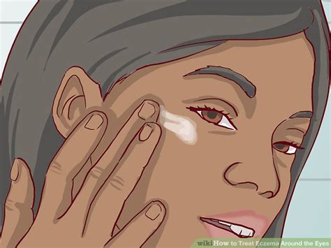How To Treat Eczema Around The Eyes Symptoms 14 Home