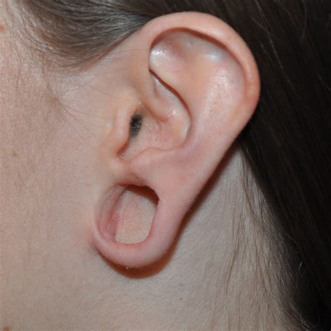 Stretched Out Earlobes