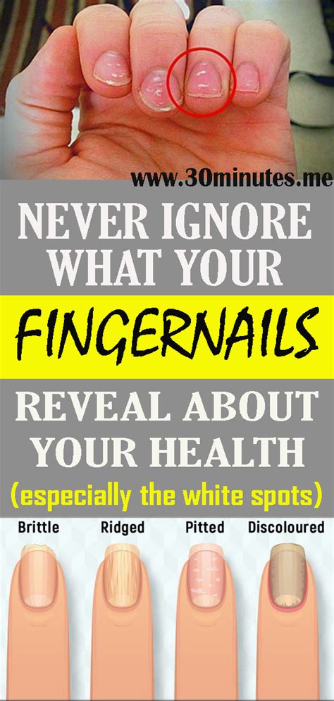 This Is What Your Fingernails Say About Your Health