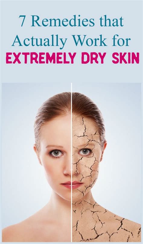 7 Tried And True Ways To Combat Extremely Dry Skin Pretty Opinionated