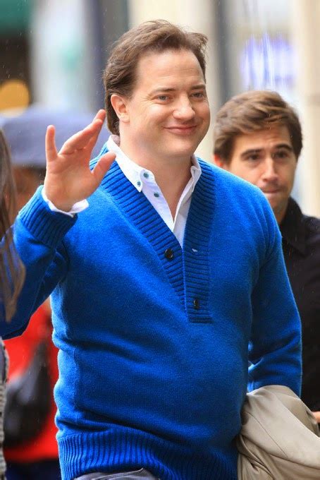 Brendan Fraser Hair Transplant