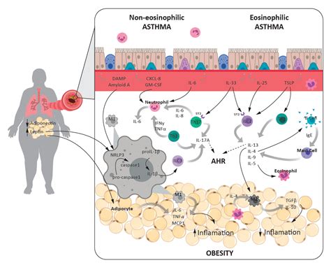 Jcm Free Full Text Asthma And Obesity Two Diseases On The Rise And Bridged By Inflammation