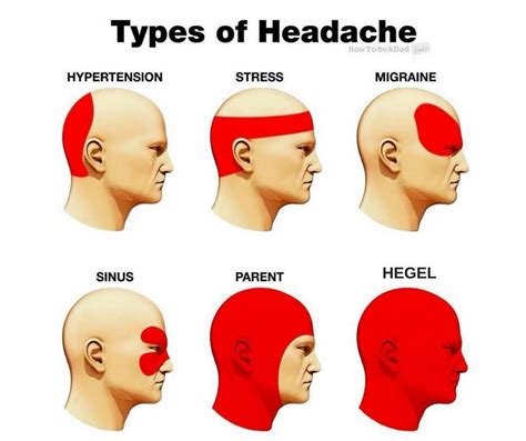 Headache Location Crazy Funny Memes Really Funny Memes Funny