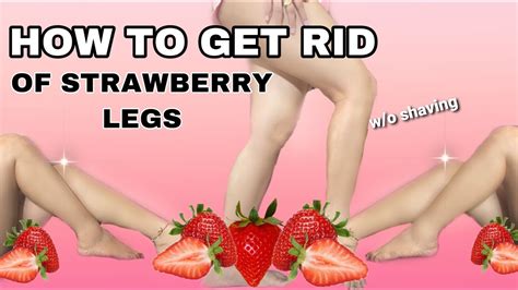 How To Get Rid Of Strawberry Legs Naturally Without Shaving Vel Ina