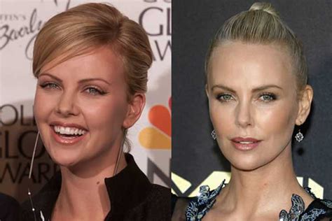 Charlize Theron Plastic Surgery Nose Job Facelift Eyelid Surgical
