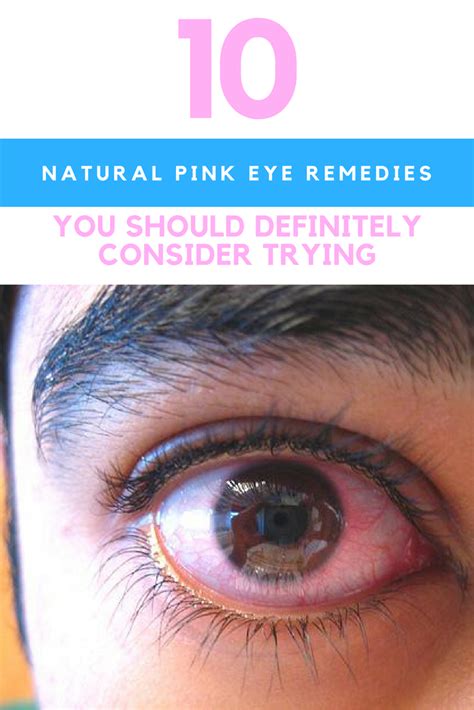 10 Natural Pink Eye Remedies That Really Work Pinkeye Remedies Pink Eye Cure Natural Pink