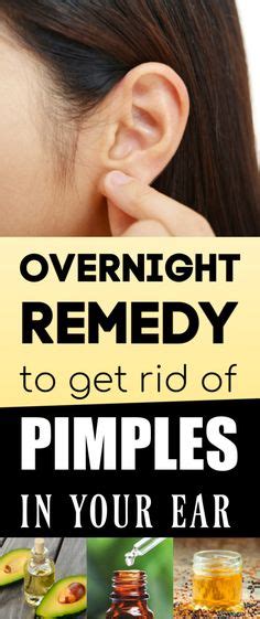 3 Ways To Get Rid Of Pimples Inside The Ear Wikihow Ear Pimple How