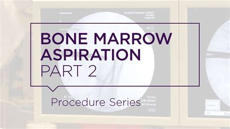 A bone marrow aspiration and biopsy can be used to diagnose blood and bone marrow conditions such as leukemia. Bone Marrow Aspiration - Part 2 - YouTube