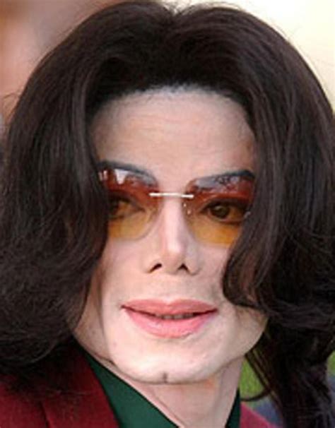 Michael Jackson Tenía Los Brazos Llenos De Pinchazos Y Sufría Artritis