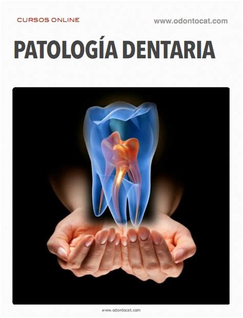 Odontocat Curso Online De Patología Dentaria