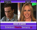 Stars Plastic Surgery Before and After: Alexis Arquette has Plastic ...