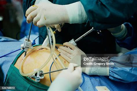 Abdomen Incision Photos And Premium High Res Pictures Getty Images