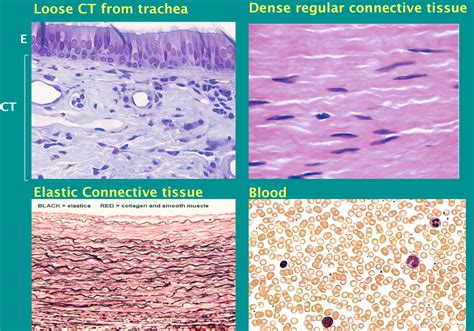 Histology Connective Tissue Flashcards