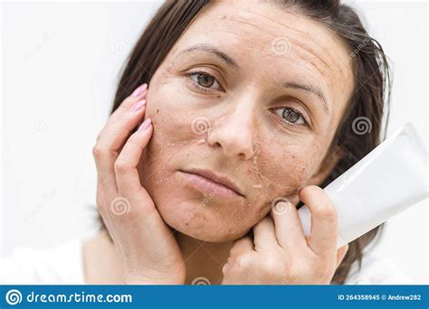 Cropped Photo Of Woman With Dry Skin And Cream On White Background