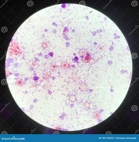 Budding Yeast Cell Structure Find With Microscope In Laboratory Stock