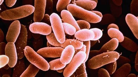 Listeria monocytogenes is the species of pathogenic bacteria that causes the infection listeriosis. Reser's Recalls Products Due to Concerns Over ...