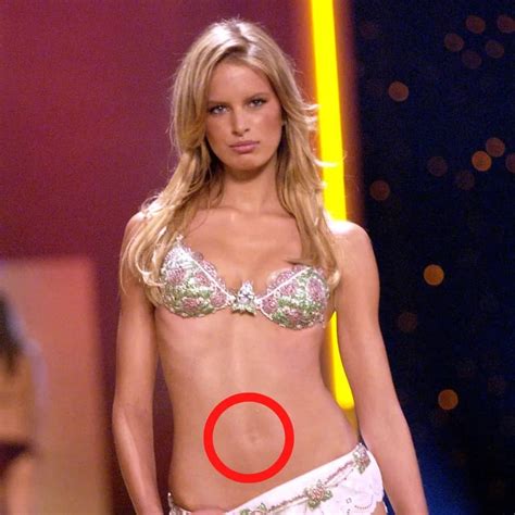 Celebrities With Body Abnormalities You Probably Didnt Know About