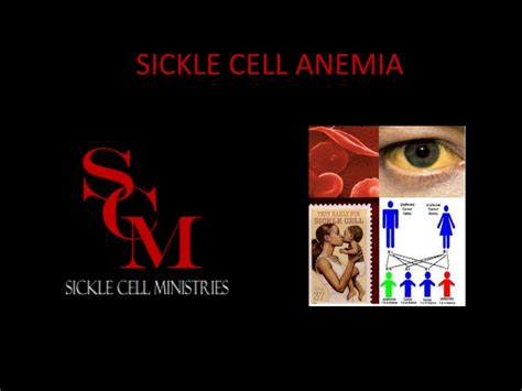 Ppt Sickle Cell Anemia Powerpoint Presentation Free Download Id393020