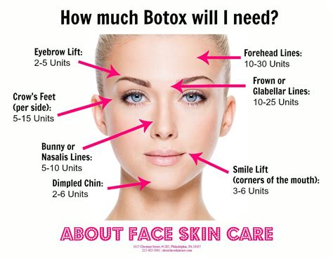 Pin On Best Of Injectables Botox And Fillers
