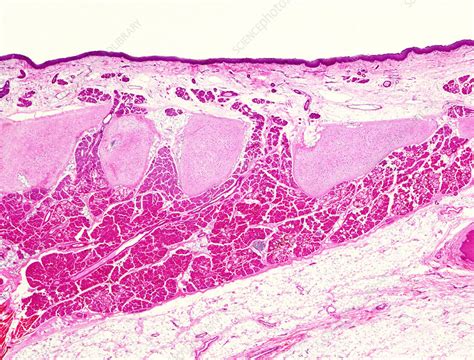 Human Lingual Tonsil Light Micrograph Stock Image C0488556