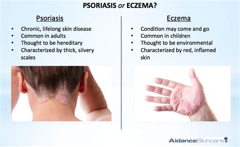 Difference Between Psoriasis And Dermatitis Dorothee Padraig South