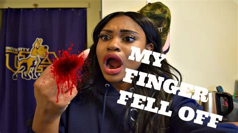 Storytime The Time My Finger Fell Off Youtube
