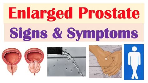 Enlarged Prostate Signs And Symptoms And Why They Occur
