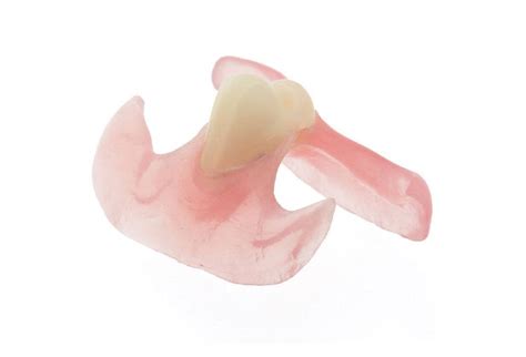 Nesbit Partial Denture Direct Dental Prosthetics