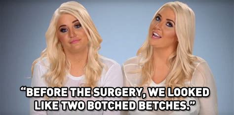 Lopsided Boobs And More 9 Omg Moments From Tonights Botched E News