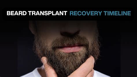 Beard Transplant Recovery Timeline Bluemagic Clinic
