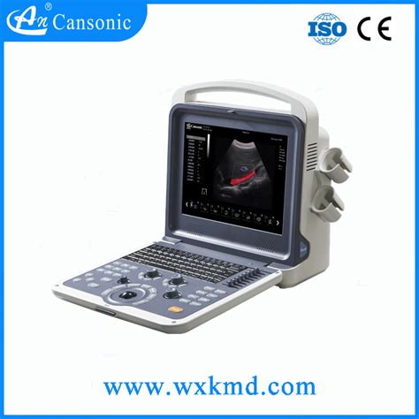 High Resolution 4d Ultrasound Scanner With Build In Battery China 4d