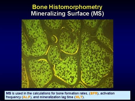 Bone Histology And Histopathology For Clinicians A Primer