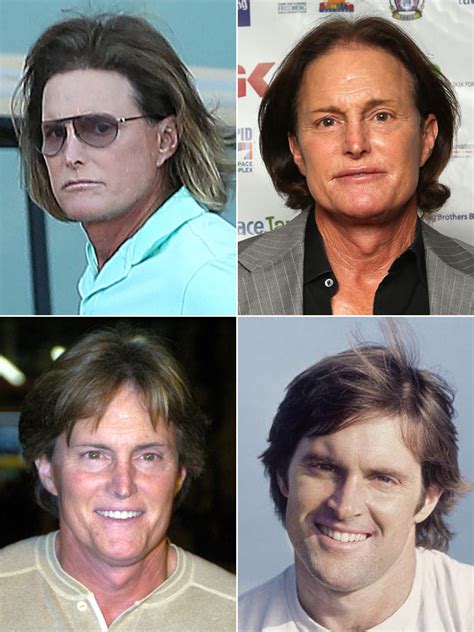 Pics Bruce Jenners Plastic Surgery — A Scary Facial Transformation Hollywood Life