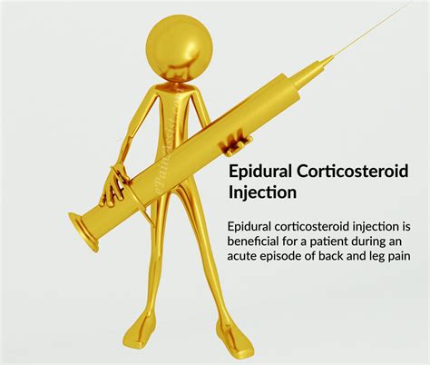 Epidural Corticosteroid Injection A Treatment Choice For Back Pain