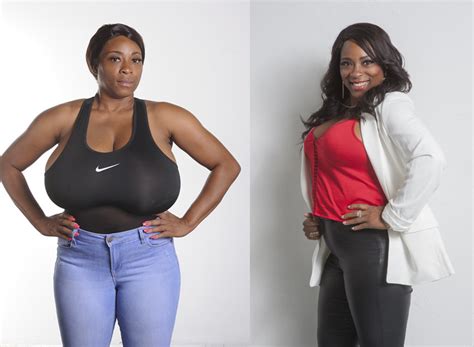 Biggest Natural Breasts In Texas Woman Has 36jjj Breast Reduction