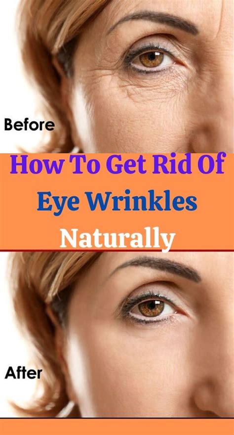 How To Get Rid Of Wrinkles Under Your Eyes Naturally Skincare