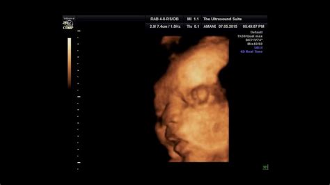 Ultrasound 4d Scan Baby Girl 36 Weeks Youtube