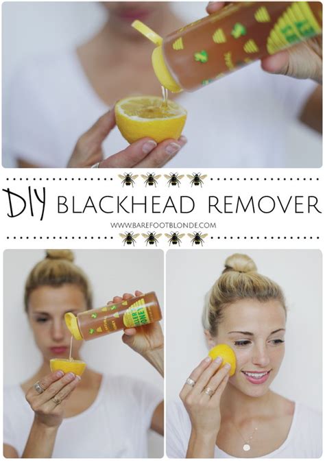 How to remove whiteheads at home. Homemade Blackheads Remover Tutorials and Ideas - Hative