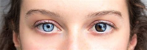 Why Do People Have Different Eye Colors Worldatlas