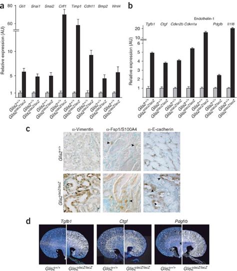 Loss Of Glis2 Causes Nephronophthisis In Humans And Mice By Increased